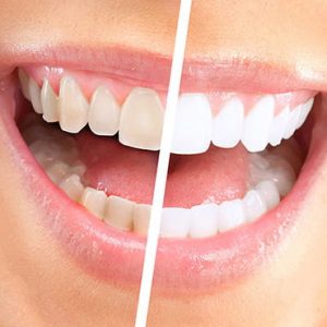 browns line dental services cosmetic dentistry background image